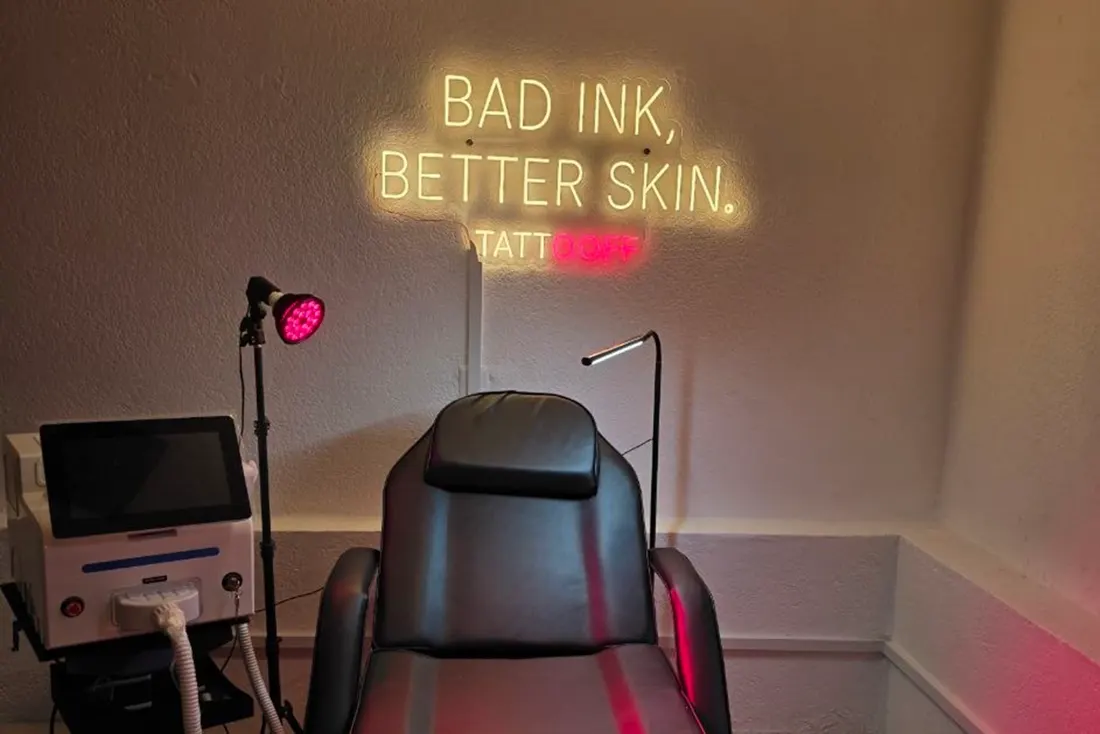 Cabina de tratamiento de TATTOOFF en Coyoacán con equipo láser Q-Switch Nd:YAG certificado